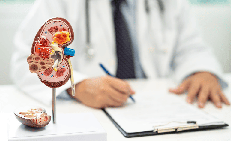 Cáncer Renal y Urotelial ofrecido por el Dr. Hugo Enrique Ochoa Gutiérrez: Diagnóstico y Tratamiento Integral