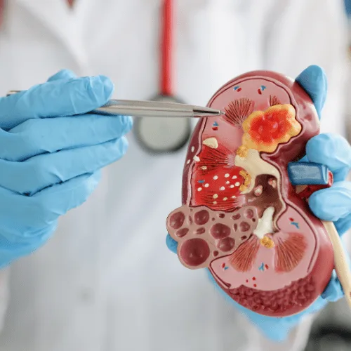 ¿Qué especialista trata el varicocele?